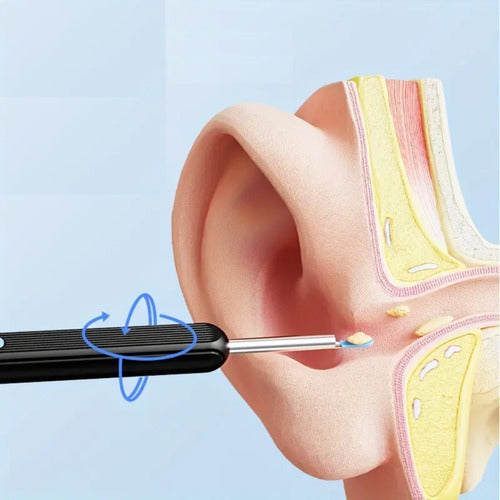 Limpiador Oído Otoscopio Inalámbrico Cámara HD Recargable