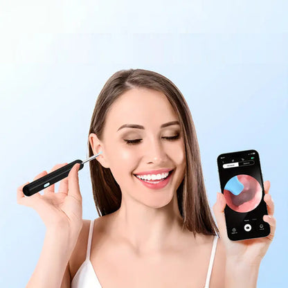 Limpiador Oído Otoscopio Inalámbrico Cámara HD Recargable
