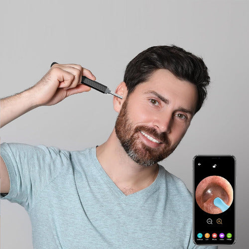 Limpiador Oído Otoscopio Inalámbrico Cámara HD Recargable