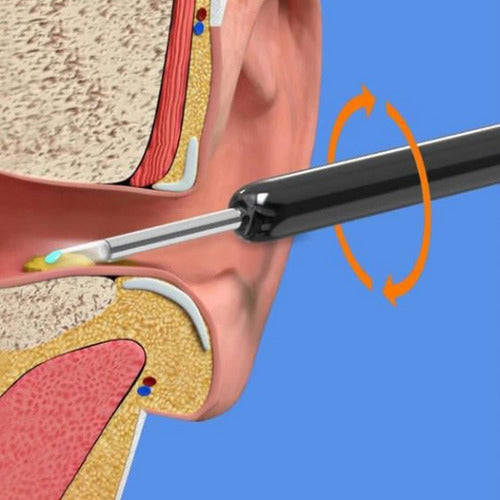 Limpiador Oído Otoscopio Inalámbrico Cámara HD Recargable